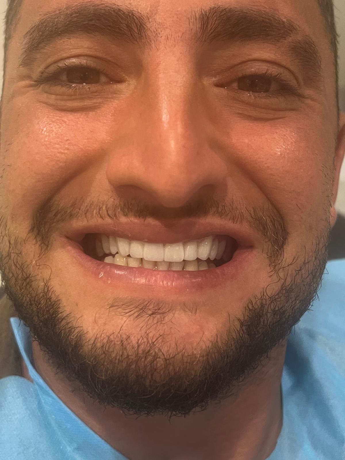 ECE Dental Patient Transformation